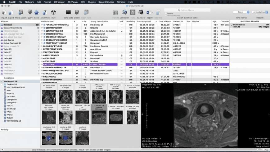 Osirix Dicom Viewer For Mac Free Download